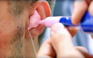 Come effettuare l’impronta per il calco dell’orecchio